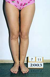 The results of the treatment