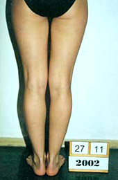 The results of the treatment.