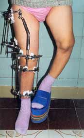 After the operation.