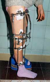 After the operation.
