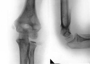 Results of treatment.