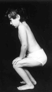 Results of treatment.