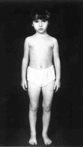 Results of treatment.