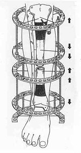 Replacement phase of spin-bone's defect