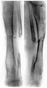 Results of treatment.