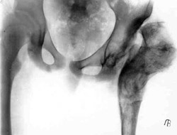 Results of treatment.