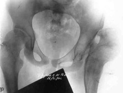 Results of treatment.