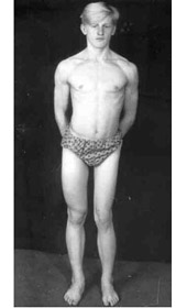 Results of treatment (Patient).