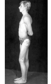 Results of treatment (Patient).