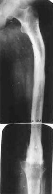 Results of treatment.